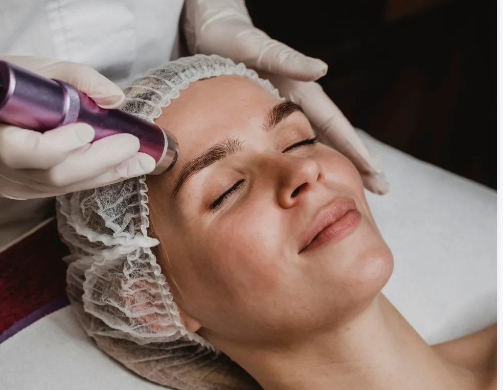 Séance de microneedling au SkinPen